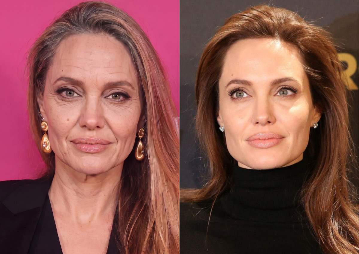 Prima e dopo XFILLER